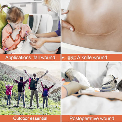 Zipper Band-aid Painless Wound Closure Device Suture-free Wound Dressing