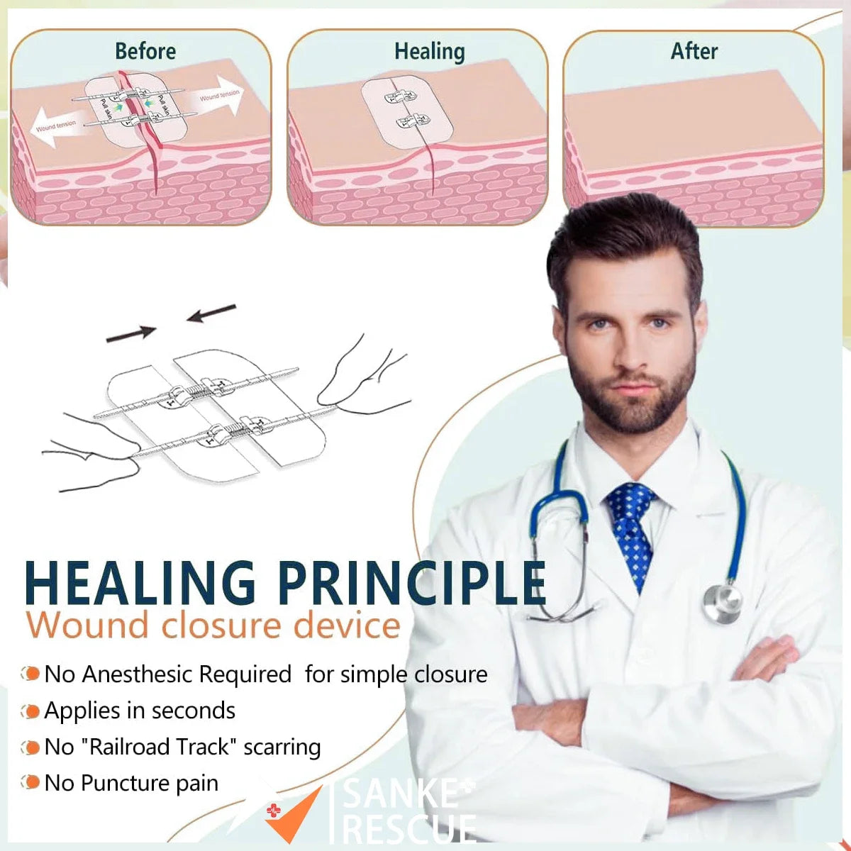 Zipper Band-aid Painless Wound Closure Device Suture-free Wound Dressing