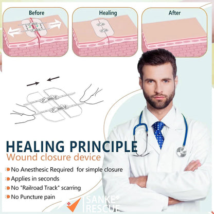 Zipper Band-aid Painless Wound Closure Device Suture-free Wound Dressing