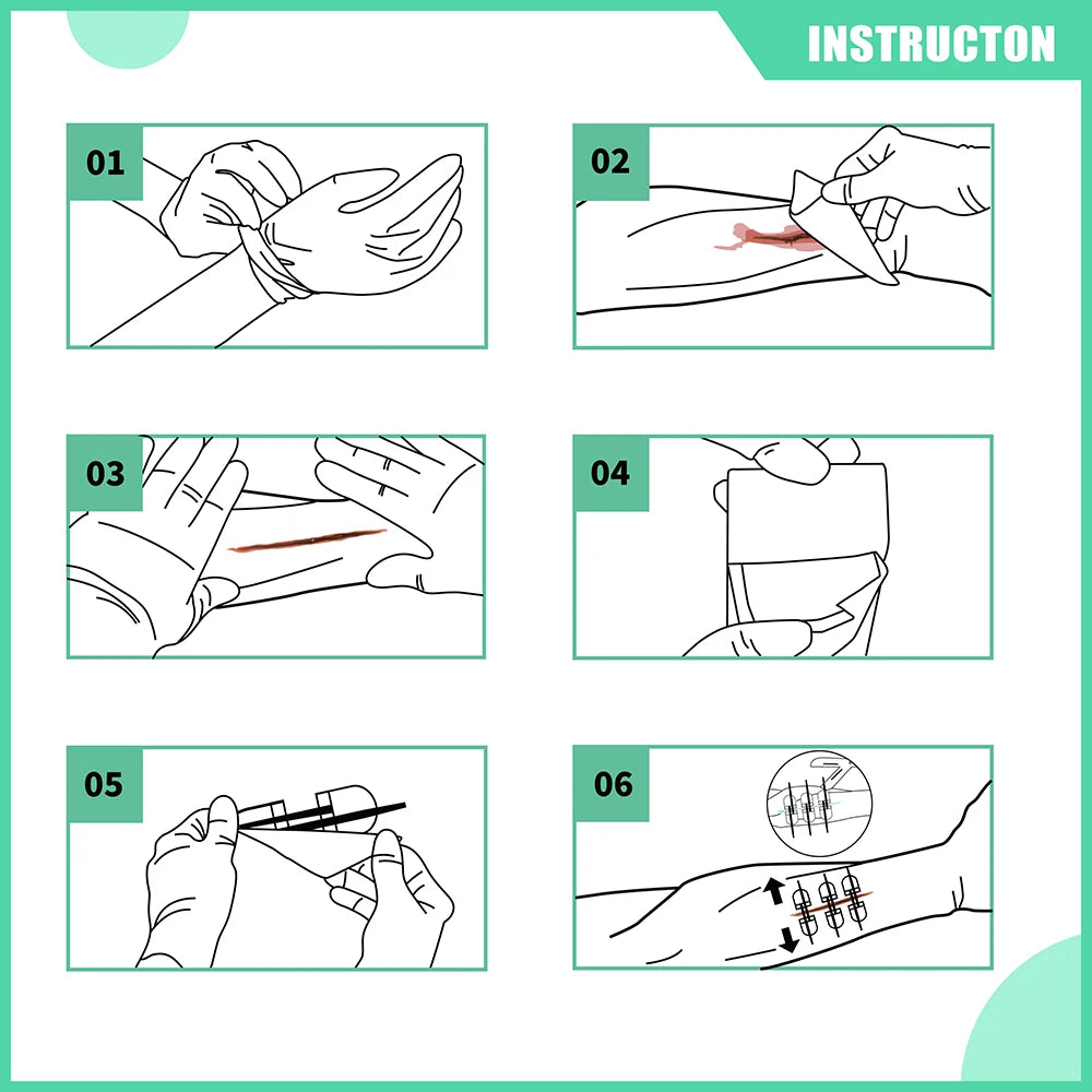 RESCUE Zip Stitch 6pcs with Wound Dressings, Wound Closure Strips,