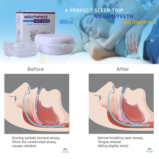 Reusable Anti Snore Mouth Guard with Storage Box