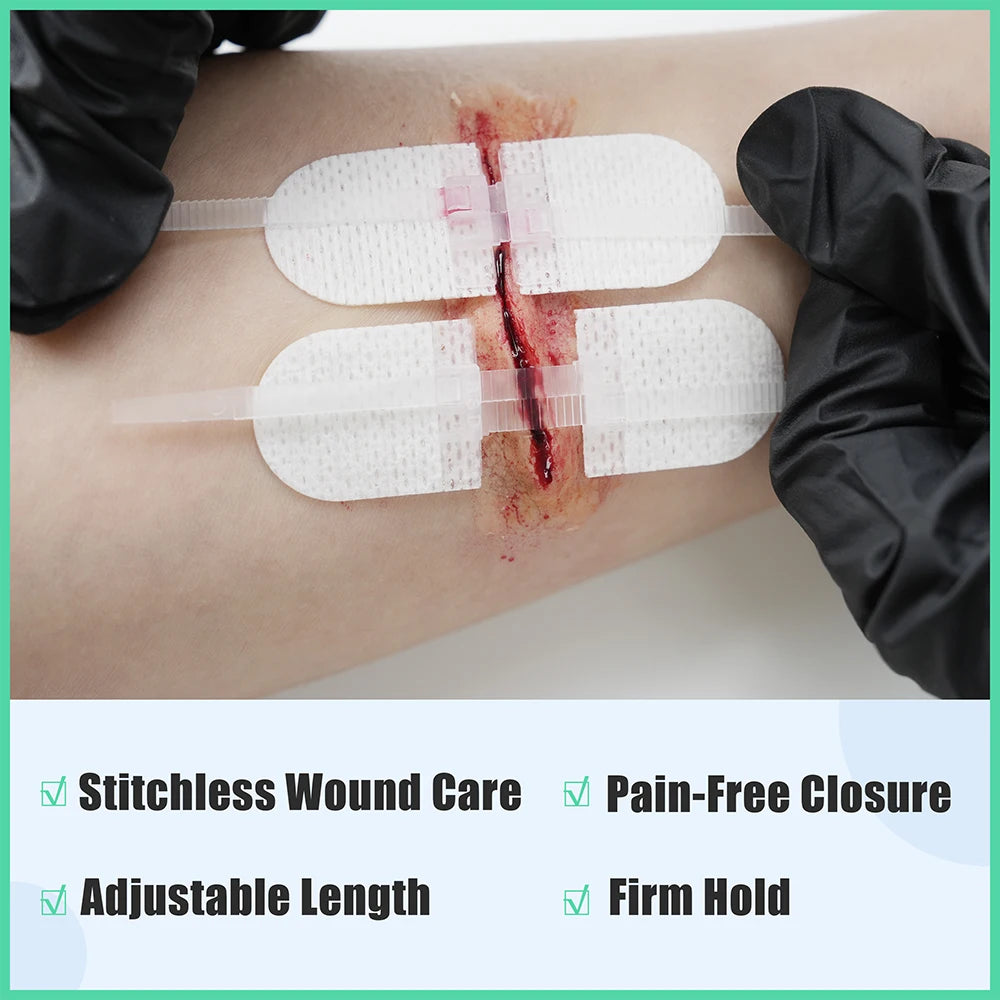RESCUE Zip Stitch 6pcs with Wound Dressings, Wound Closure Strips,